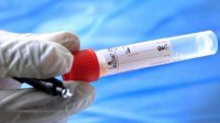 Первый случай южноафриканского штамма коронавируса в Болгарии